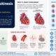 Heart Hypokinesis