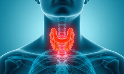 Heterogeneous Thyroid