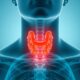 Heterogeneous Thyroid