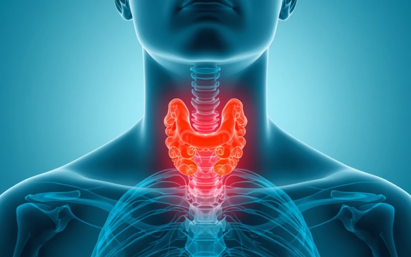 Heterogeneous Thyroid