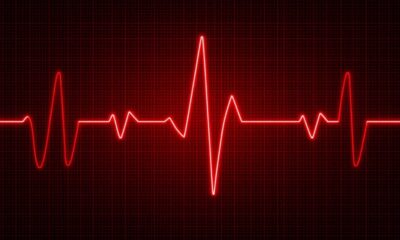 Atrial Flutter vs Atrial Fibrillation