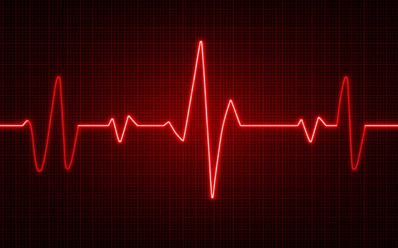Atrial Flutter vs Atrial Fibrillation